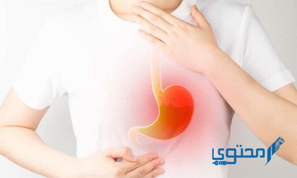 أسباب أعراض ارتجاع المريء وأسماء الكبسولات لعلاجه 