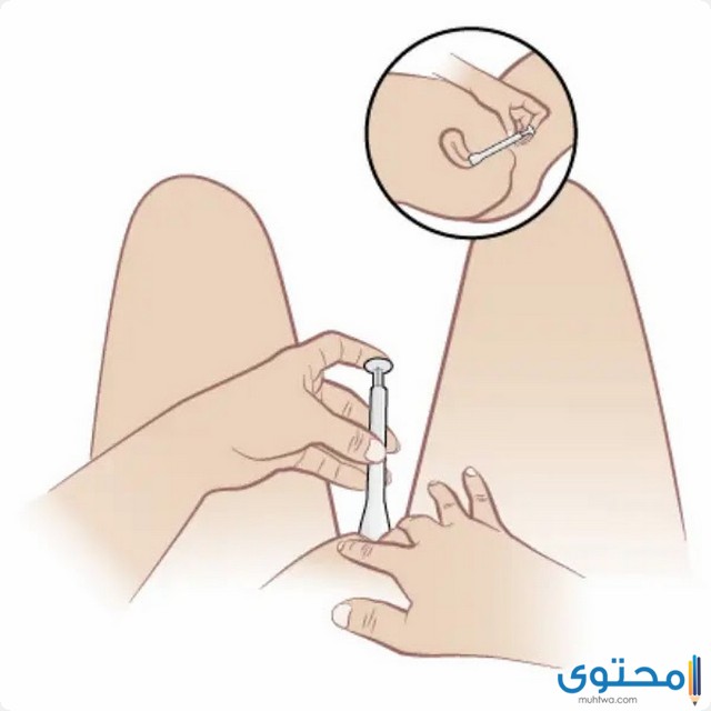 التحاميل المهبلية