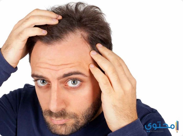 زراعة الشعر الطبيعي في تركيا