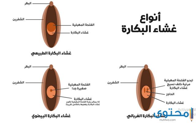 غشاء البكارة